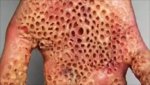 trypophobia-450x253.jpg